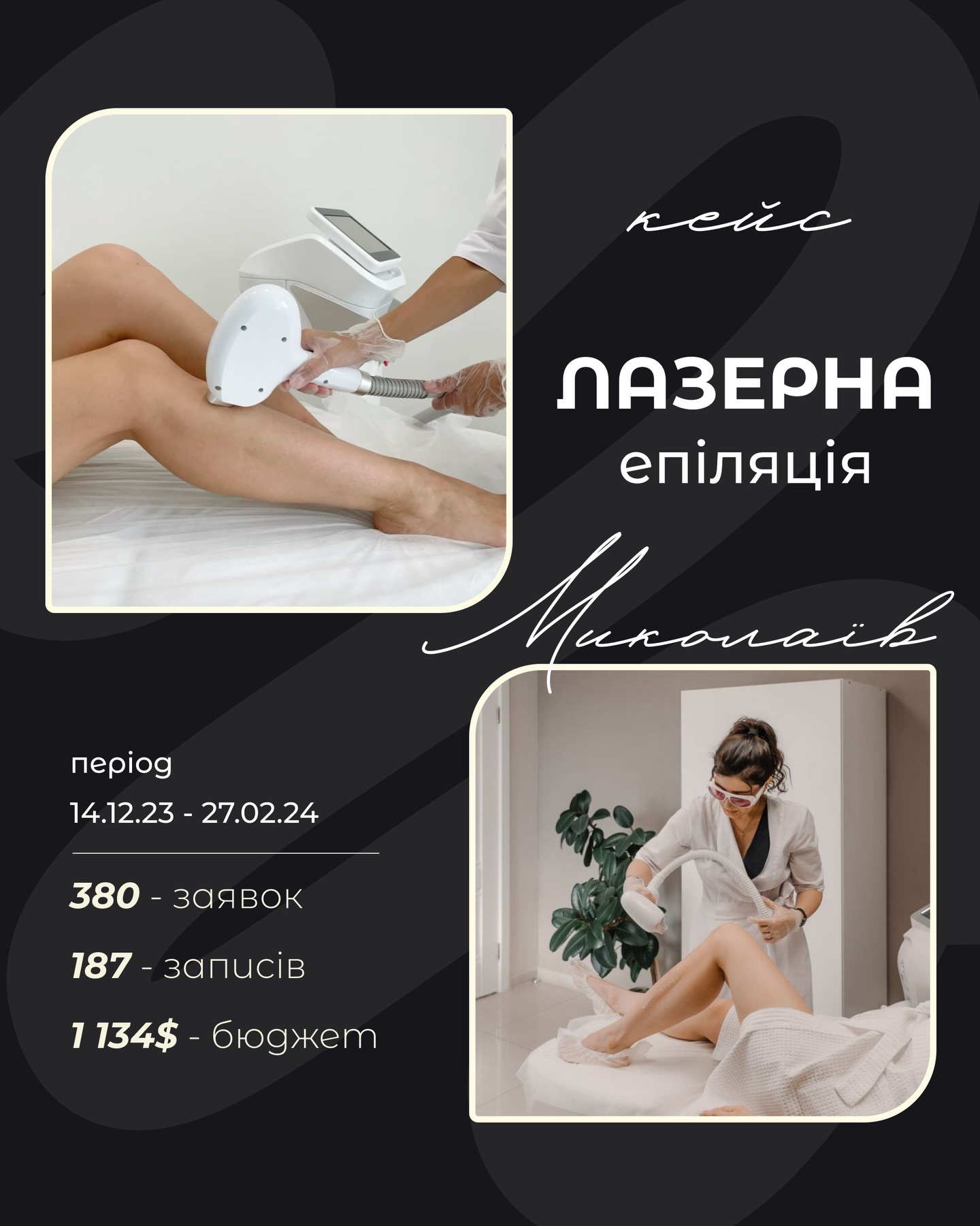 187 записів із 380 лідів